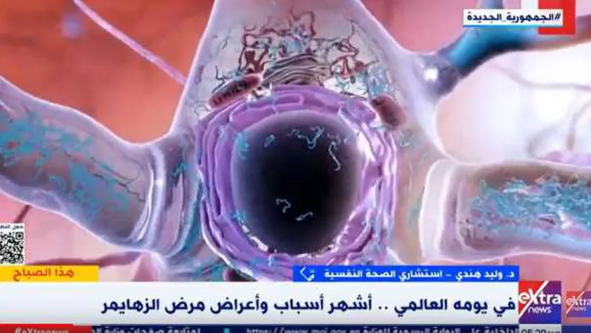 استشاري صحة نفسية: معدل الإصابة بـ«ألزهايمر» يزداد عند سن 65 عاما
| يلا شوت